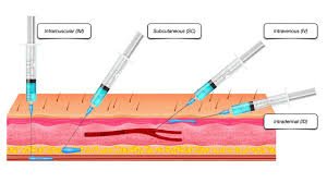 Injection IV